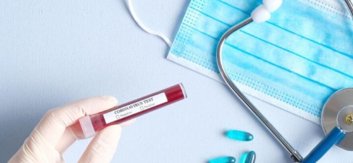 Avusturya’da Son 24 saat içinde 31 bin 409 kişiye Corona testi yapıldı