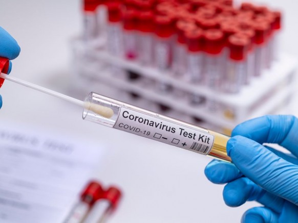 Viyana’da Ücretsiz Korona Test Talebi Başvuruları Başladı