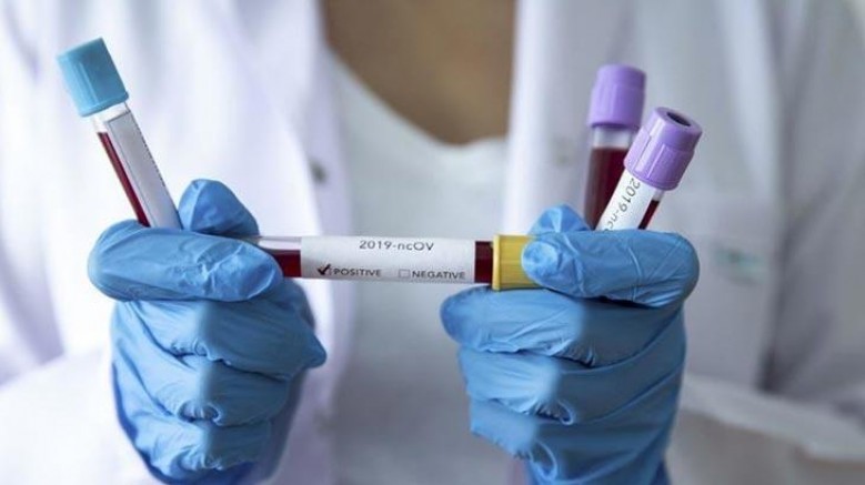 Finlandiya’da yeni virüs mutasyonu keşfedildi