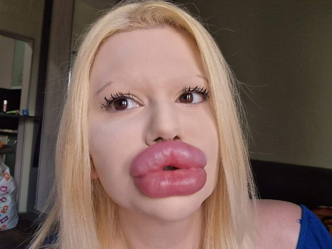 Dünyanın en kalın dudaklarına sahip kadını aşk hayatındaki eksiklikten şikayet ediyor